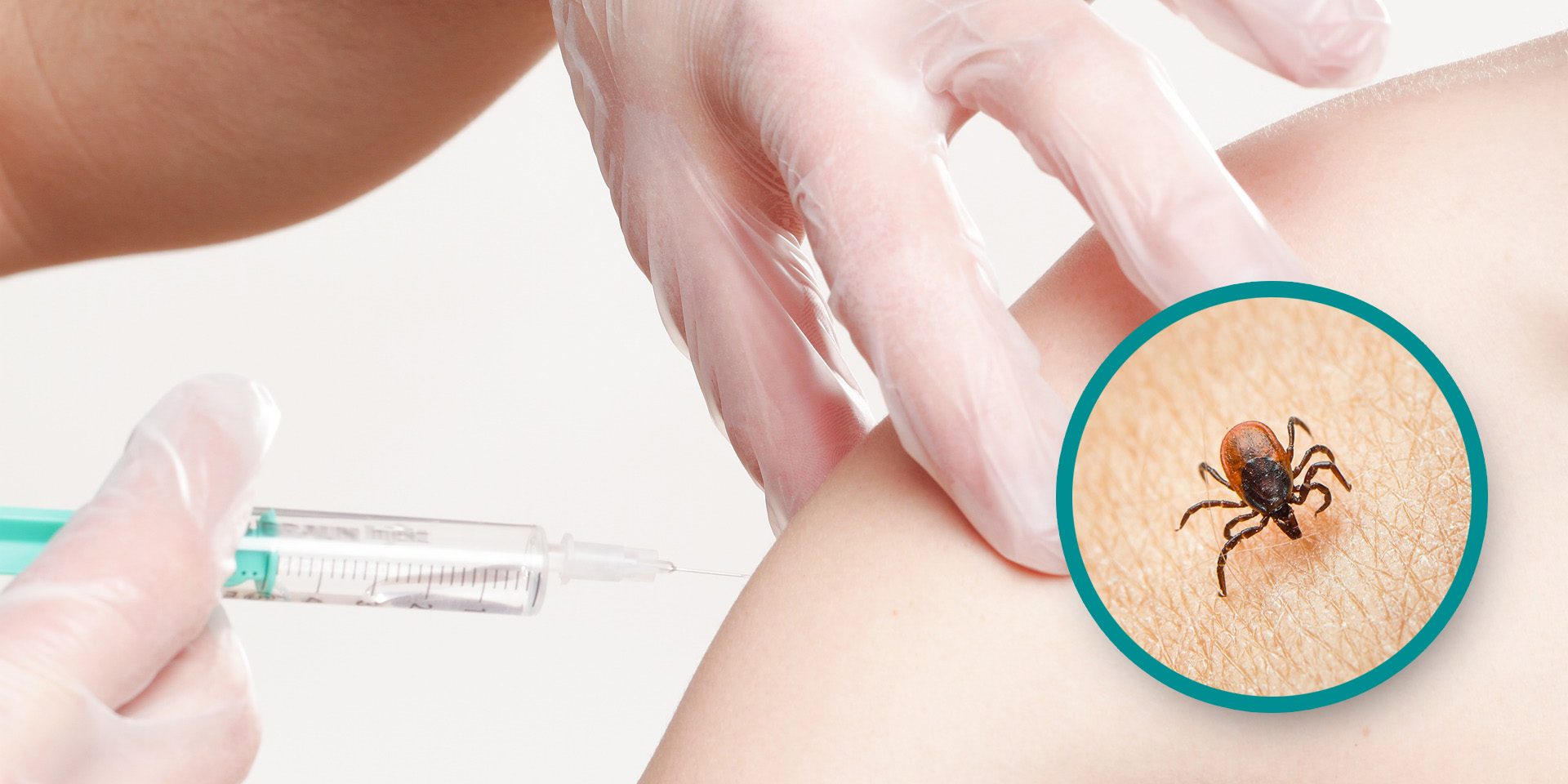 cepljenje-klop_splet